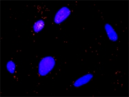 H00000823-D01P - Calpain-1