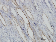 H00000826-M01 - CAPNS1