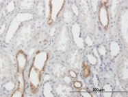 H00000828-B01P - Calcyphosin