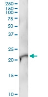 H00000828-D01 - Calcyphosin
