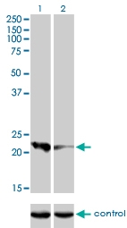 H00000828-M01 - Calcyphosin