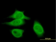 H00000831-B01 - Calpastatin