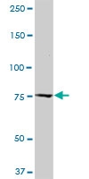 H00000831-M03 - Calpastatin