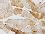 H00000845-M07 - Calsequestrin-2