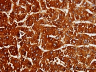 H00000875-M01 - CBS