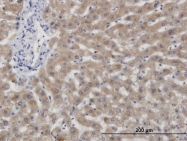 H00000875-M05 - CBS