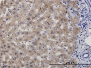 H00000875-M06 - CBS
