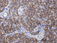 H00000875-M07 - CBS