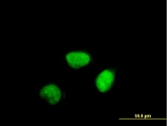 H00000890-B01 - Cyclin A2