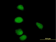 H00000898-B03P - Cyclin E1