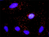 H00000898-D01P - Cyclin E1