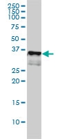 H00000909-M01 - CD1a