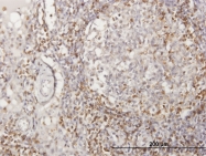 H00000914-B02 - CD2