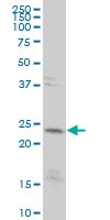 H00000916-M04 - CD3