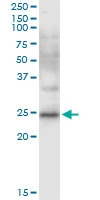 H00000926-D01 - CD8 beta
