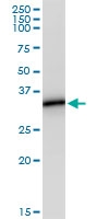 H00000931-D01 - CD20
