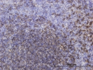 H00000931-M04 - CD20