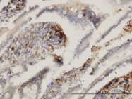 H00000955-M03 - CD39L2 / ENTPD6