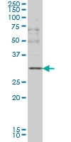 H00000959-M01 - CD154 / CD40L