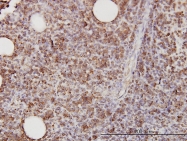 H00000965-M01 - CD58 / LFA3
