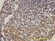 H00000965-M01 - CD58 / LFA3