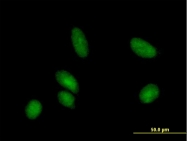 H00000978-B02P - Cytidine deaminase