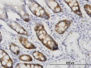 H00000983-M01 - CDK1