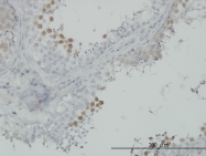 H00000983-M02 - CDK1