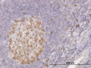 H00000983-M04 - CDK1