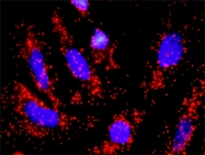 H00000990-D01P - CDC6