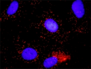 H00000990-D01P - CDC6