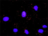 H00000990-D01P - CDC6