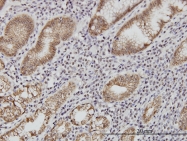 H00000999-M01 - CD324 / Cadherin-1