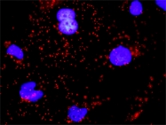 H00000999-M01 - CD324 / Cadherin-1