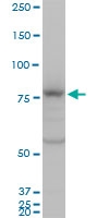H00001003-A01 - CD144 / Cadherin-5
