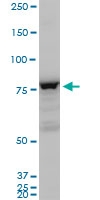 H00001003-A01 - CD144 / Cadherin-5