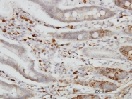 H00001016-M01 - Cadherin-18