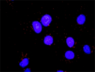 H00001017-D01P - CDK2