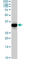 H00001017-M02 - CDK2