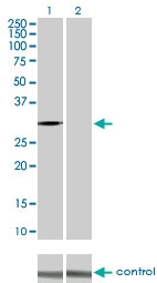 H00001017-M02 - CDK2