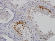 H00001018-M01 - CDK3