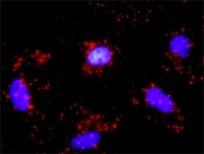H00001019-D01P - CDK4