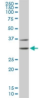 H00001019-M03 - CDK4