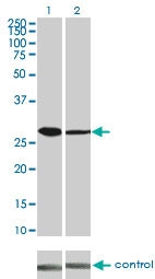H00001019-M03 - CDK4