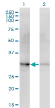 H00001019-M10 - CDK4