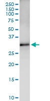 H00001020-D01 - CDK5