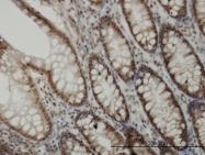 H00001021-M01 - CDK6