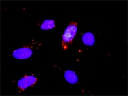 H00001021-M01 - CDK6