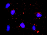 H00001022-D01P - CDK7