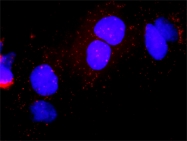 H00001022-D01P - CDK7